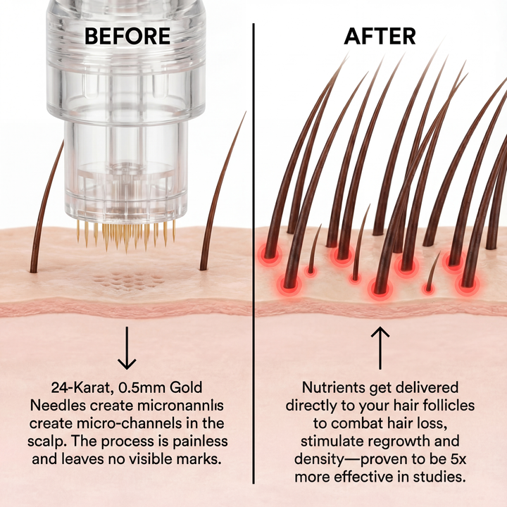 Regain Now™ Hair Regain System