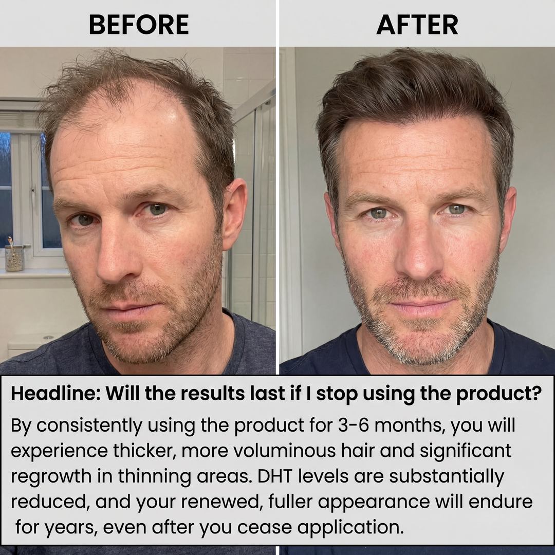 Regain Now™ Hair Regain System